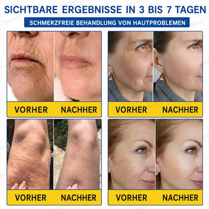 𝐍𝐚𝐭𝐫𝐚𝐯𝐨𝐫® PDRN Anti-Faltenpflege – Liftende Straffungscreme für ein glatteres Hautbild