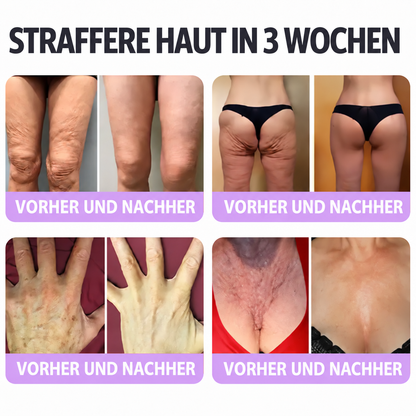 Natravor®🎗️ PDRN Multi-Peptid Massage-Roller-Creme – Anti-Aging Pflege, Feuchtigkeit, Straffung & Lifting für ein glatteres, ebenmäßigeres Hautbild