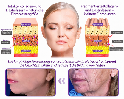 Natravor®🎗️ PDRN Multi-Peptid Massage-Roller-Creme – Anti-Aging Pflege, Feuchtigkeit, Straffung & Lifting für ein glatteres, ebenmäßigeres Hautbild