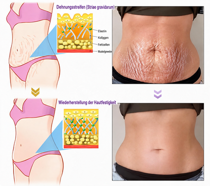 Natravor®🎗️ PDRN Multi-Peptid Massage-Roller-Creme – Anti-Aging Pflege, Feuchtigkeit, Straffung & Lifting für ein glatteres, ebenmäßigeres Hautbild