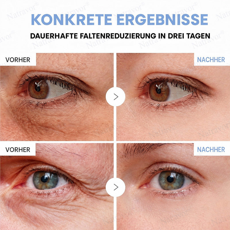 𝐍𝐚𝐭𝐫𝐚𝐯𝐨𝐫® PDRN Anti-Faltenpflege – Liftende Straffungscreme für ein glatteres Hautbild