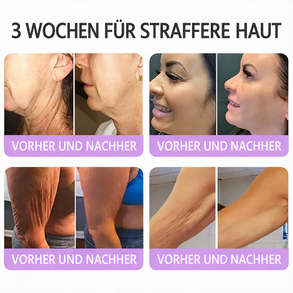 Natravor®🎗️ PDRN Multi-Peptid Massage-Roller-Creme – Anti-Aging Pflege, Feuchtigkeit, Straffung & Lifting für ein glatteres, ebenmäßigeres Hautbild