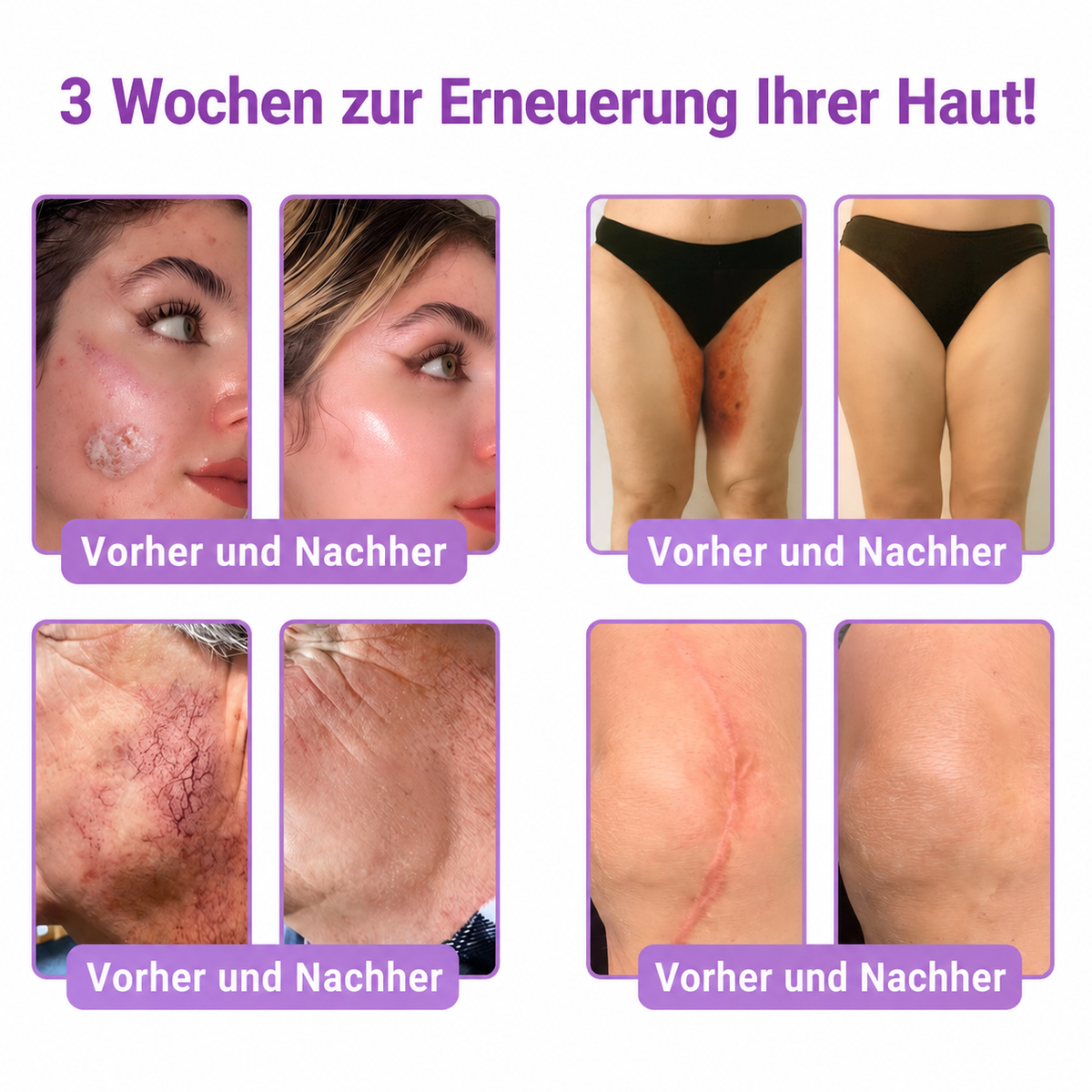 Natravor®🎗️ PDRN Multi-Peptid Massage-Roller-Creme – Anti-Aging Pflege, Feuchtigkeit, Straffung & Lifting für ein glatteres, ebenmäßigeres Hautbild