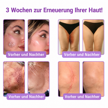 Natravor®🎗️ PDRN Multi-Peptid Massage-Roller-Creme – Anti-Aging Pflege, Feuchtigkeit, Straffung & Lifting für ein glatteres, ebenmäßigeres Hautbild
