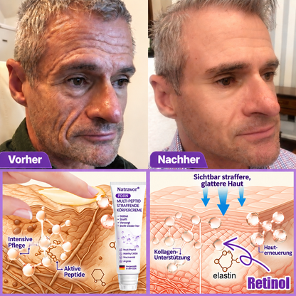 Natravor®🎗️ PDRN Multi-Peptid Massage-Roller-Creme – Anti-Aging Pflege, Feuchtigkeit, Straffung & Lifting für ein glatteres, ebenmäßigeres Hautbild
