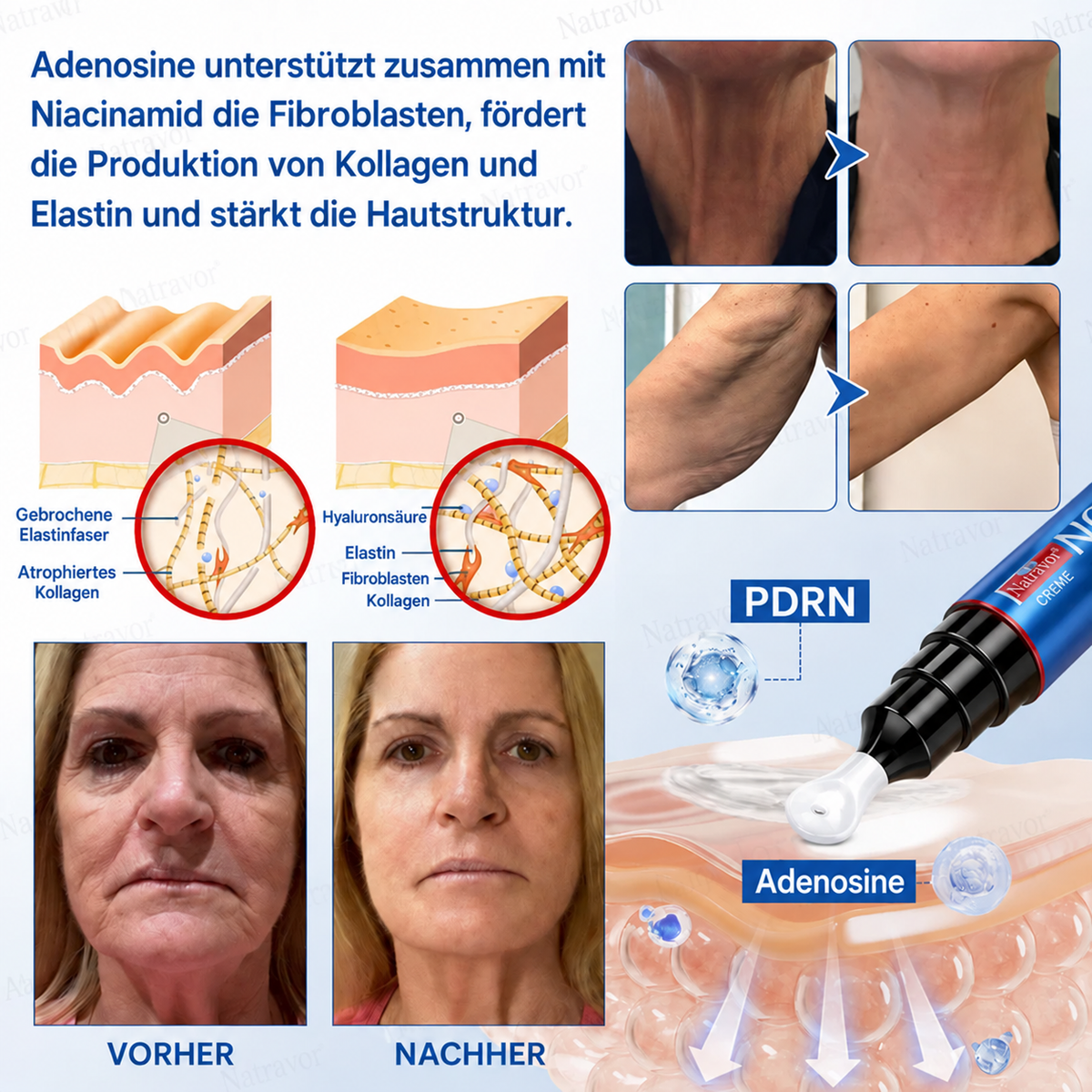𝐍𝐚𝐭𝐫𝐚𝐯𝐨𝐫® PDRN Anti-Faltenpflege – Liftende Straffungscreme für ein glatteres Hautbild