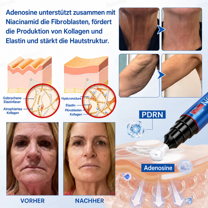 𝐍𝐚𝐭𝐫𝐚𝐯𝐨𝐫® PDRN Anti-Faltenpflege – Liftende Straffungscreme für ein glatteres Hautbild