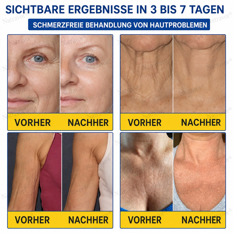 𝐍𝐚𝐭𝐫𝐚𝐯𝐨𝐫® PDRN Anti-Faltenpflege – Liftende Straffungscreme für ein glatteres Hautbild